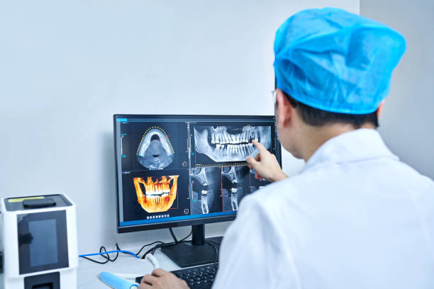 Best Emergency Dental Care for Broken or Chipped Teeth in Palm Springs North, FL